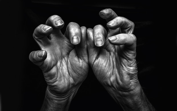 A Show of Hands