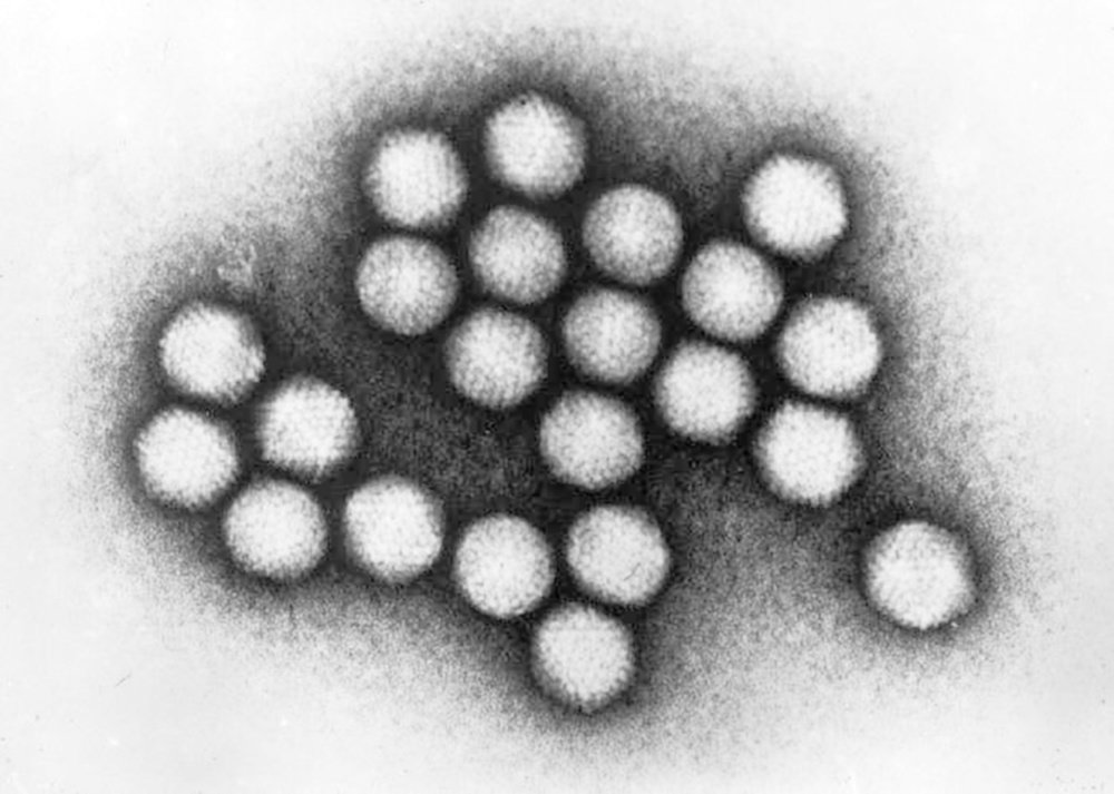 Adenowirus