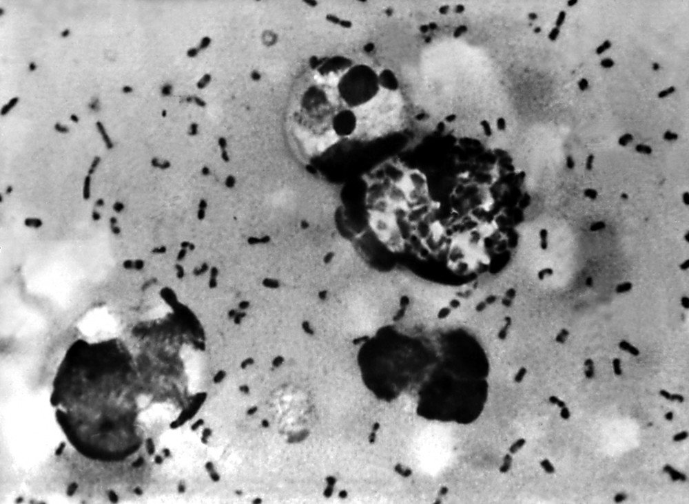Yersinia pestis bacteria, pałeczka dżumy