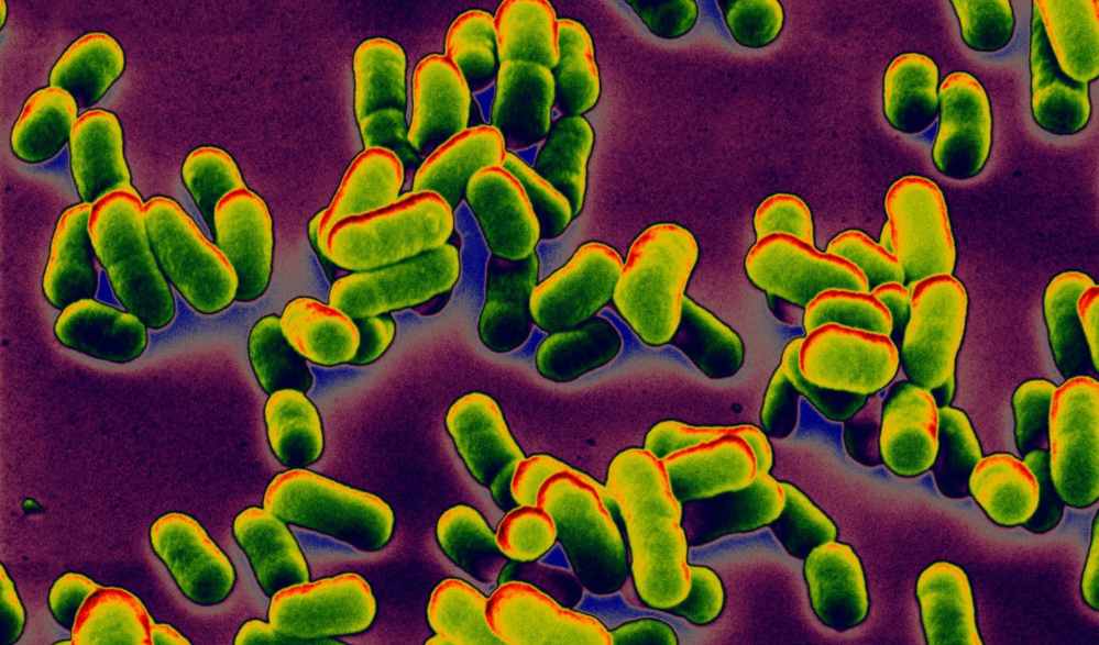 Bakteria Yersinia pestis wywołująca dżumę