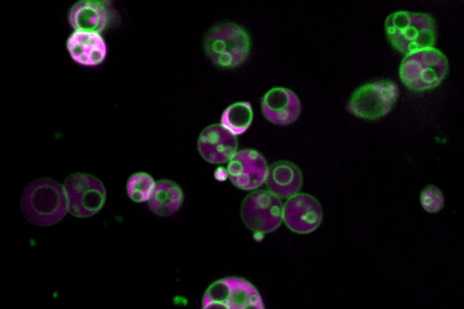 Peroksysomy komórek roślinnych Arabidopsis thaliana (Zachary Wright / Rice University)