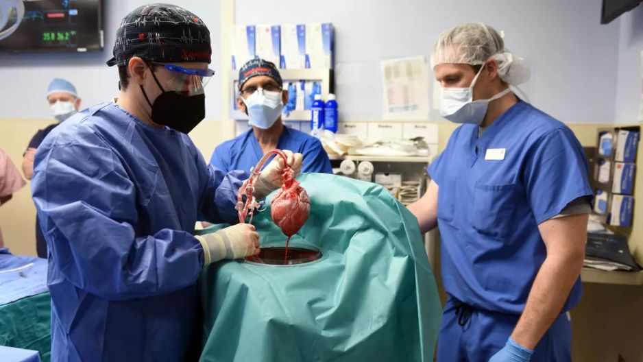 Transplantacja