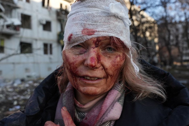 kobieta-ktora-ucierpiala-po-ataku-z-powietrzna-na-cywilna-przestrzen-charkowa-pierwszy-dzien-inwazji-fot-wolfgang-schwan-anadolu-agency-via-getty-images-19ef5ed