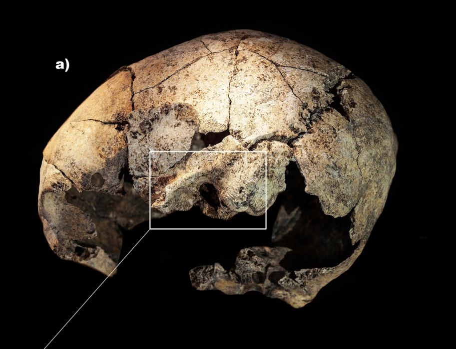 czaszka sprzed 5300 lat