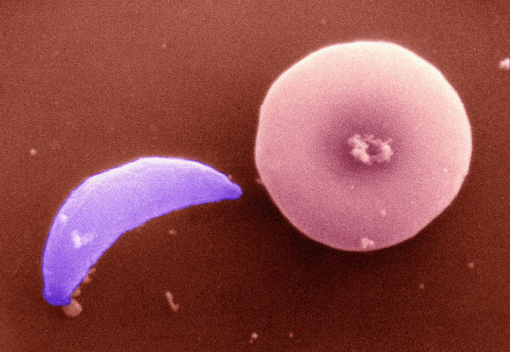Zakażenie toksoplazmozą sprawia, że ludzie stają się bardziej atrakcyjni? Zaskakujące wyniki badań (fot. BSIP/UIG Via Getty Images)