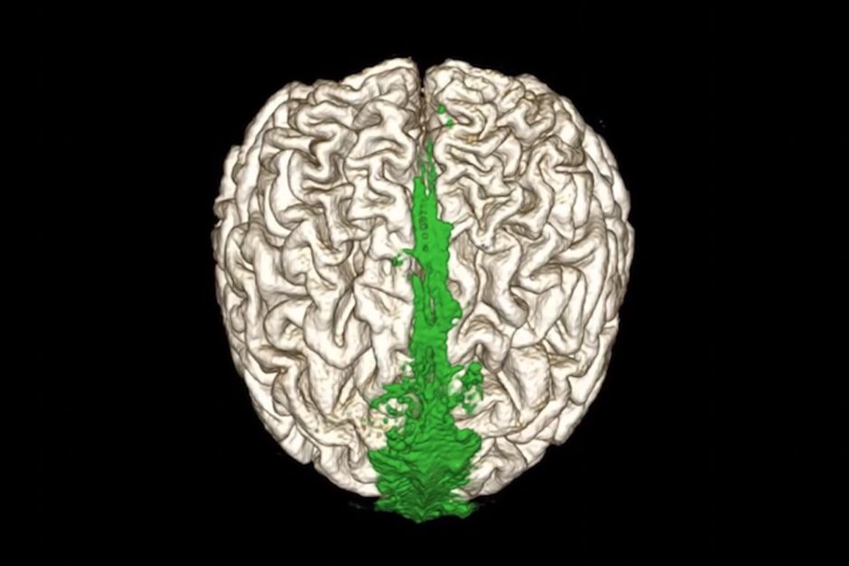 Jak działa kanalizacja w naszym mózgu? Naukowcy w końcu szczegółowo zbadali układ limfatyczny mózgu (fot. Dr. Onder Albayram, Medical University of South Carolina)