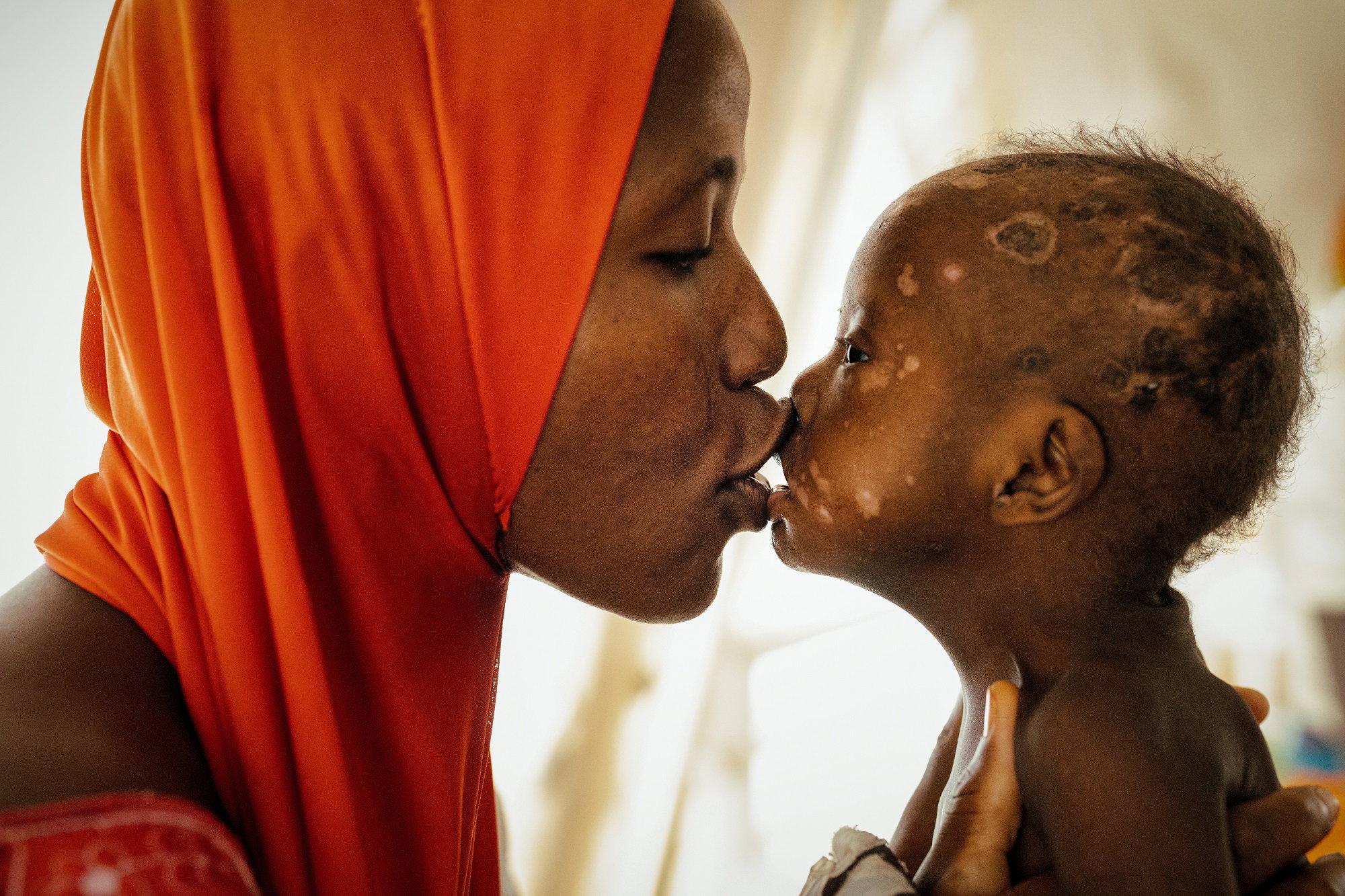 Zapraszamy na wystawę fotograficzną Yunwa („głód” w języku Hausa) (fot. Iwona El Tanbouli-Jabłońska)
