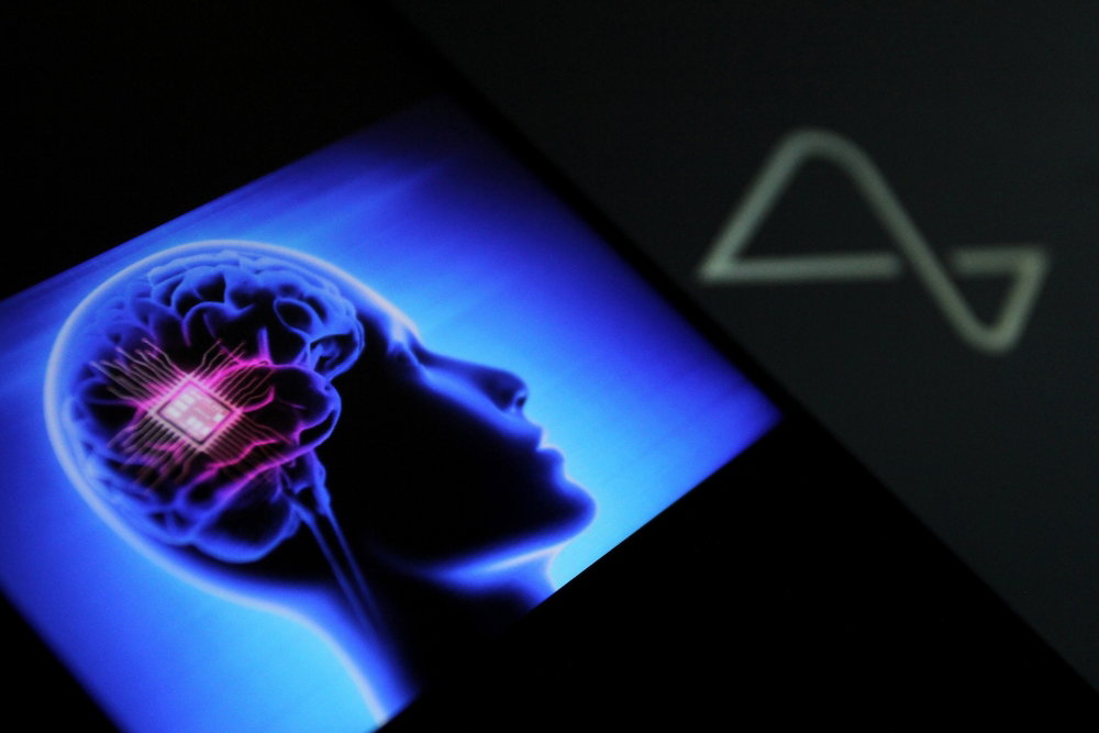 Elon Musk chce testować implant mózgowy u drugiego pacjenta. Kiedy? W ciągu najbliższych dni