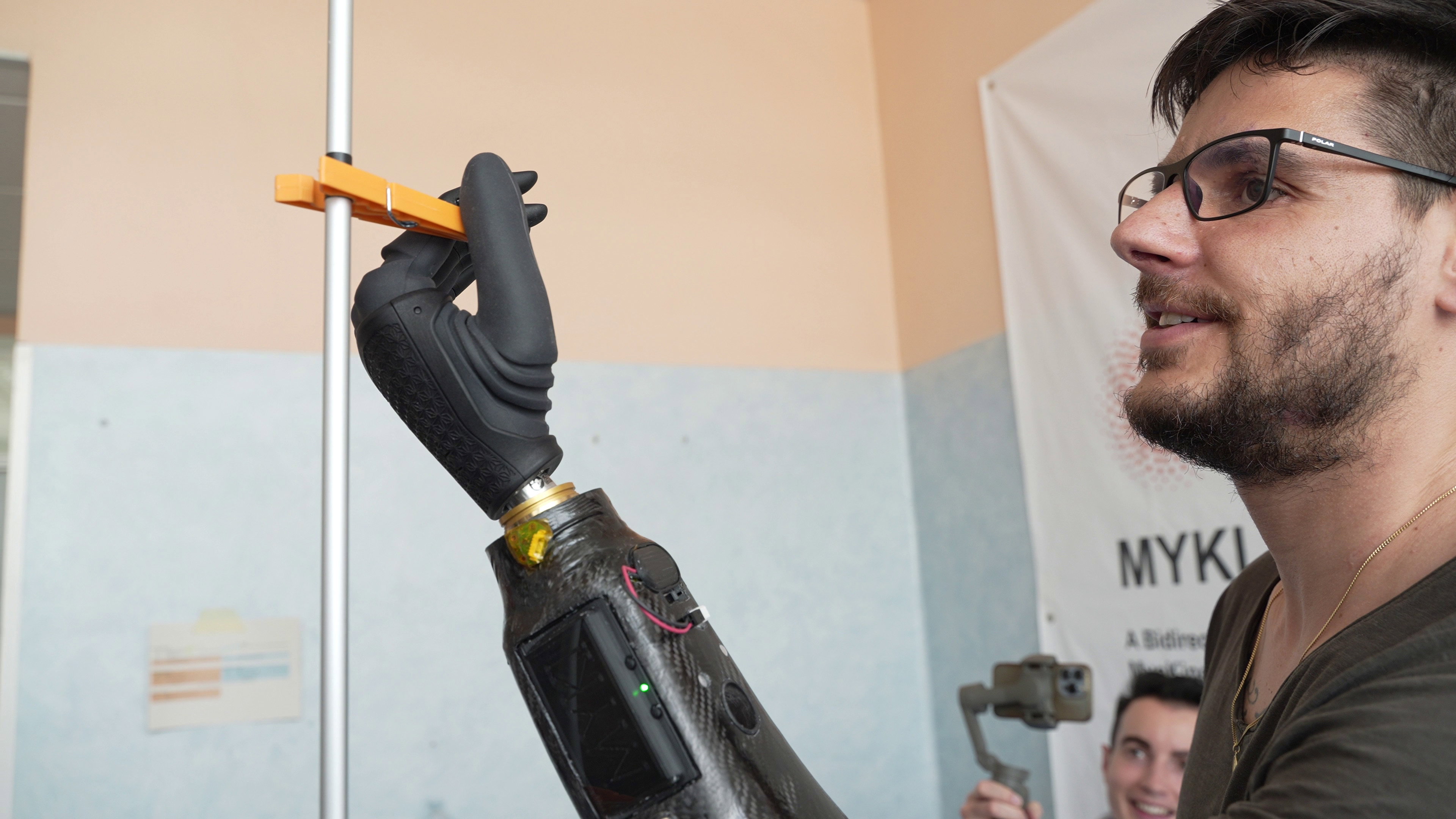Magnetyczna proteza dająca wrażenie poruszania własną ręką. Włoscy naukowcy dokonali niemożliwego