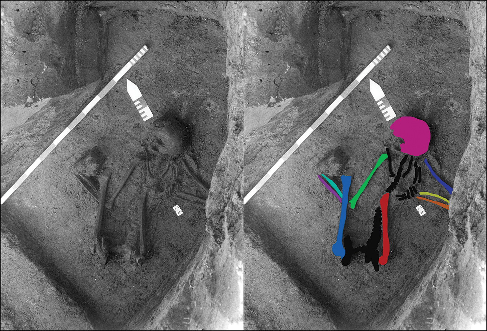 „Frankenstein” sprzed 2500 lat. Ten szkielet został ułożony z kości 5 osób