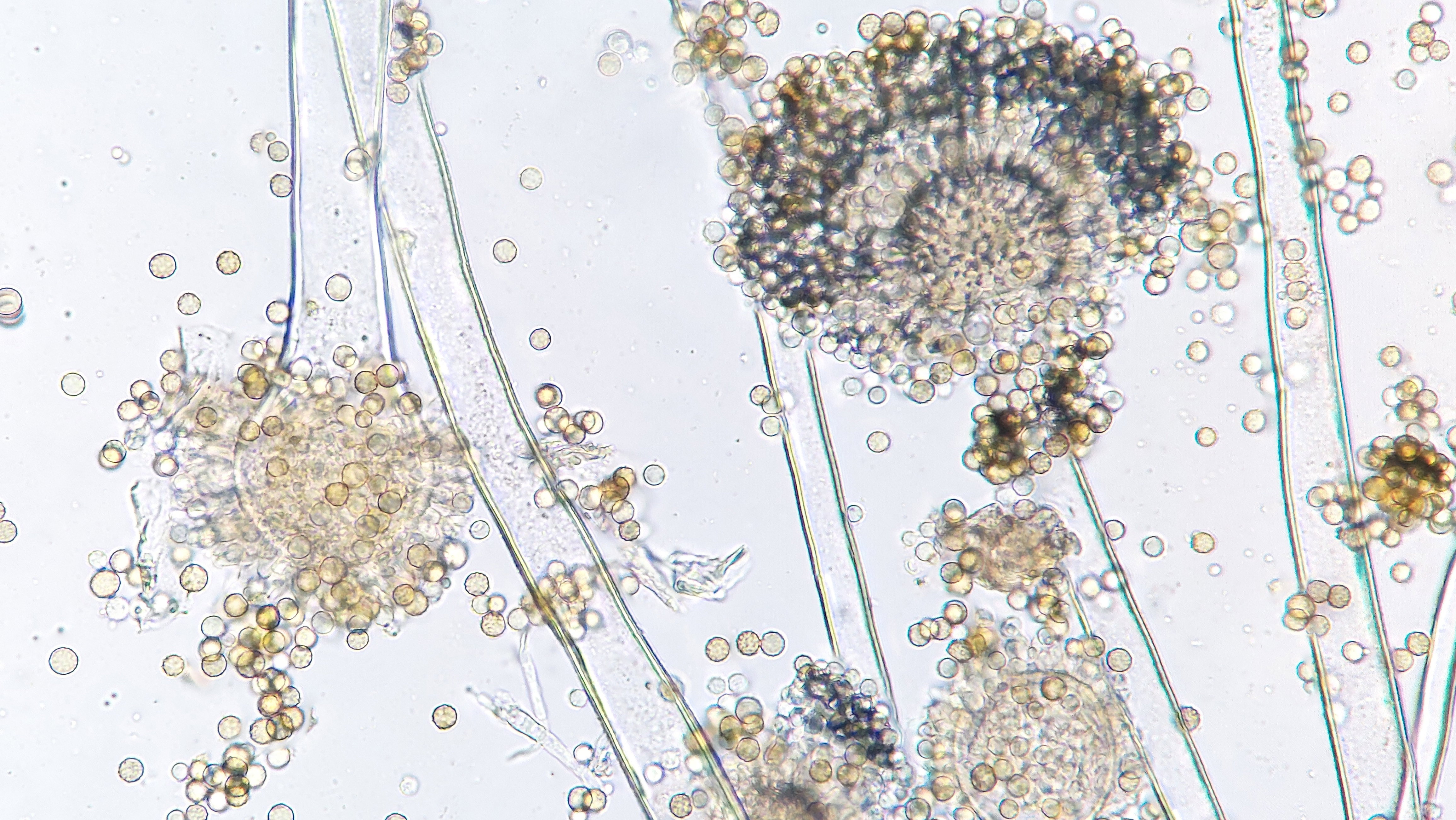 Pleśń z rodzaju Aspergillus pod mikroskopem