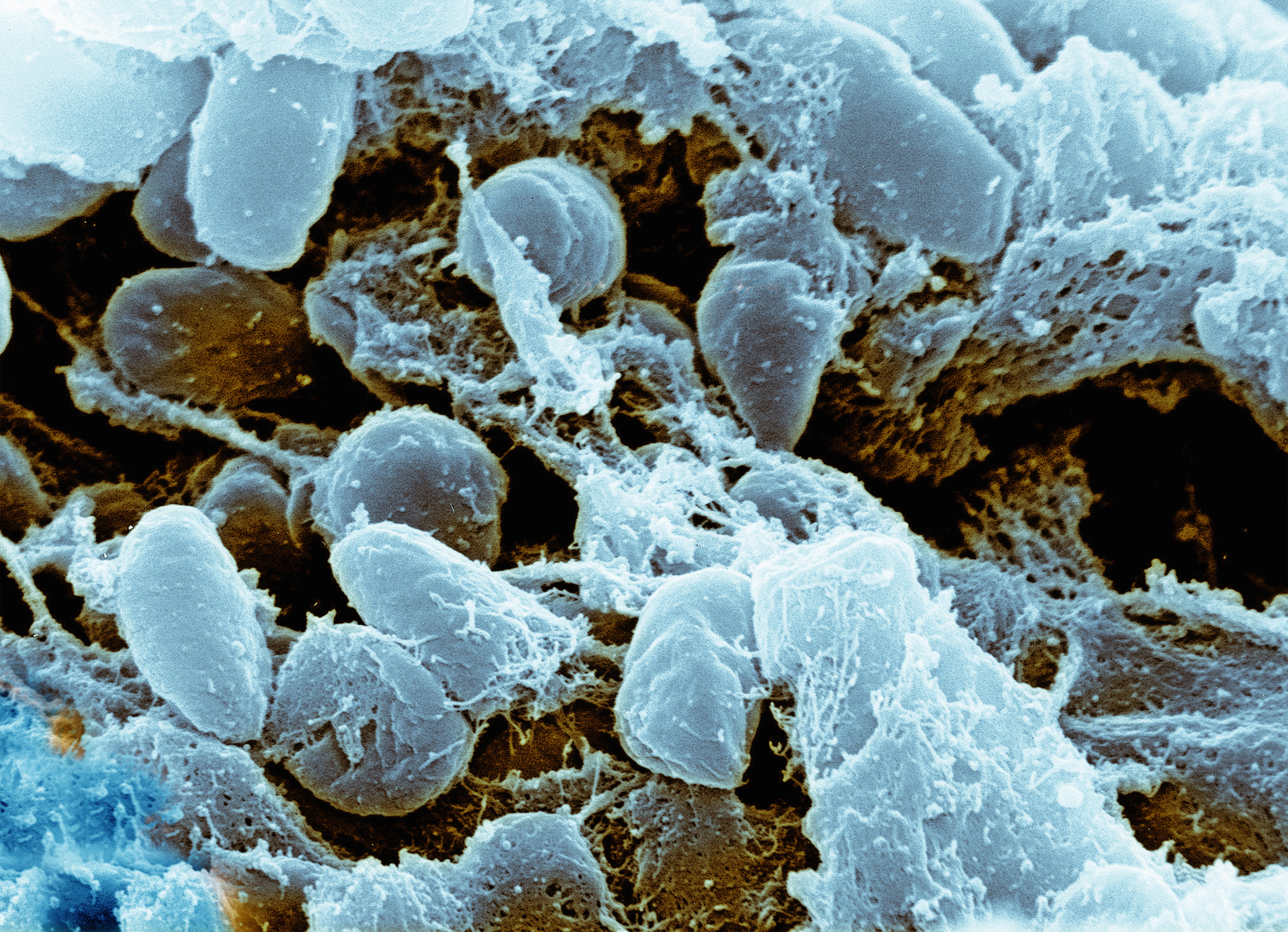 Wywołujące dżumę bakterie Yersinia pestis pod mikroskopem elektronowym