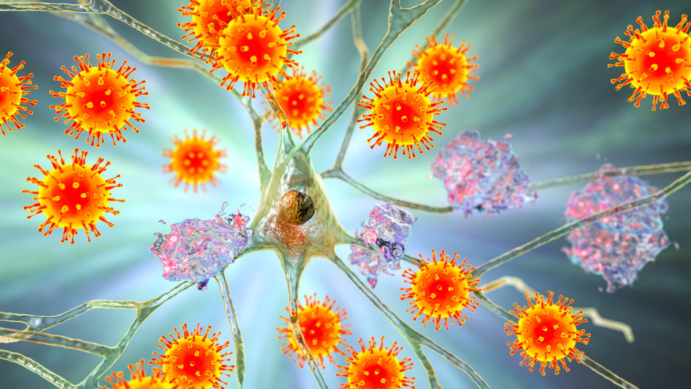 wczesne objawy alzheimera