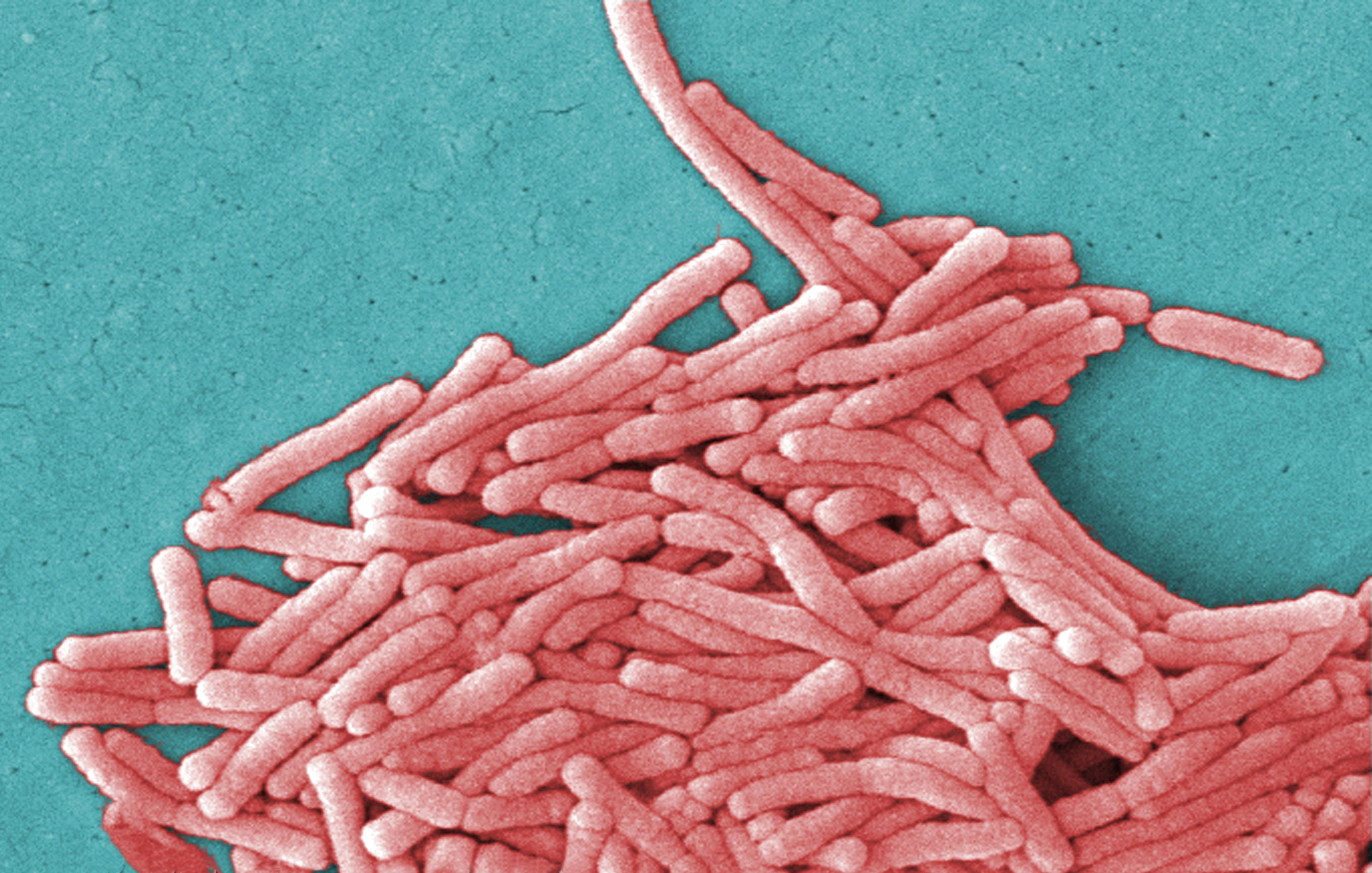 Bakterie Legionella wywołały ognisko zakażeń w Nowym Jorku