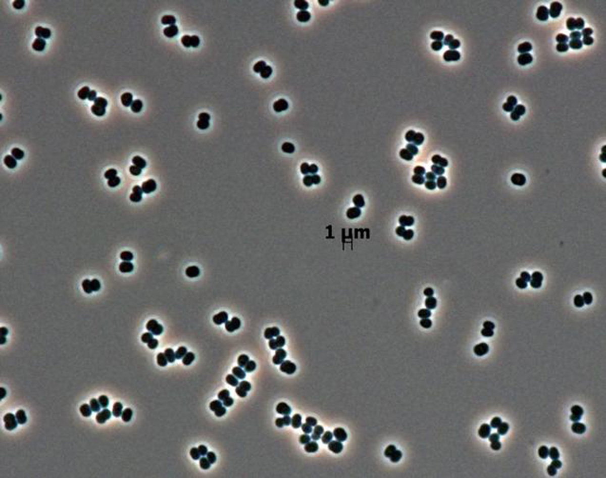 Bakteria Tersicoccus Phoenicis odkryta w pomieszczeniach NASA