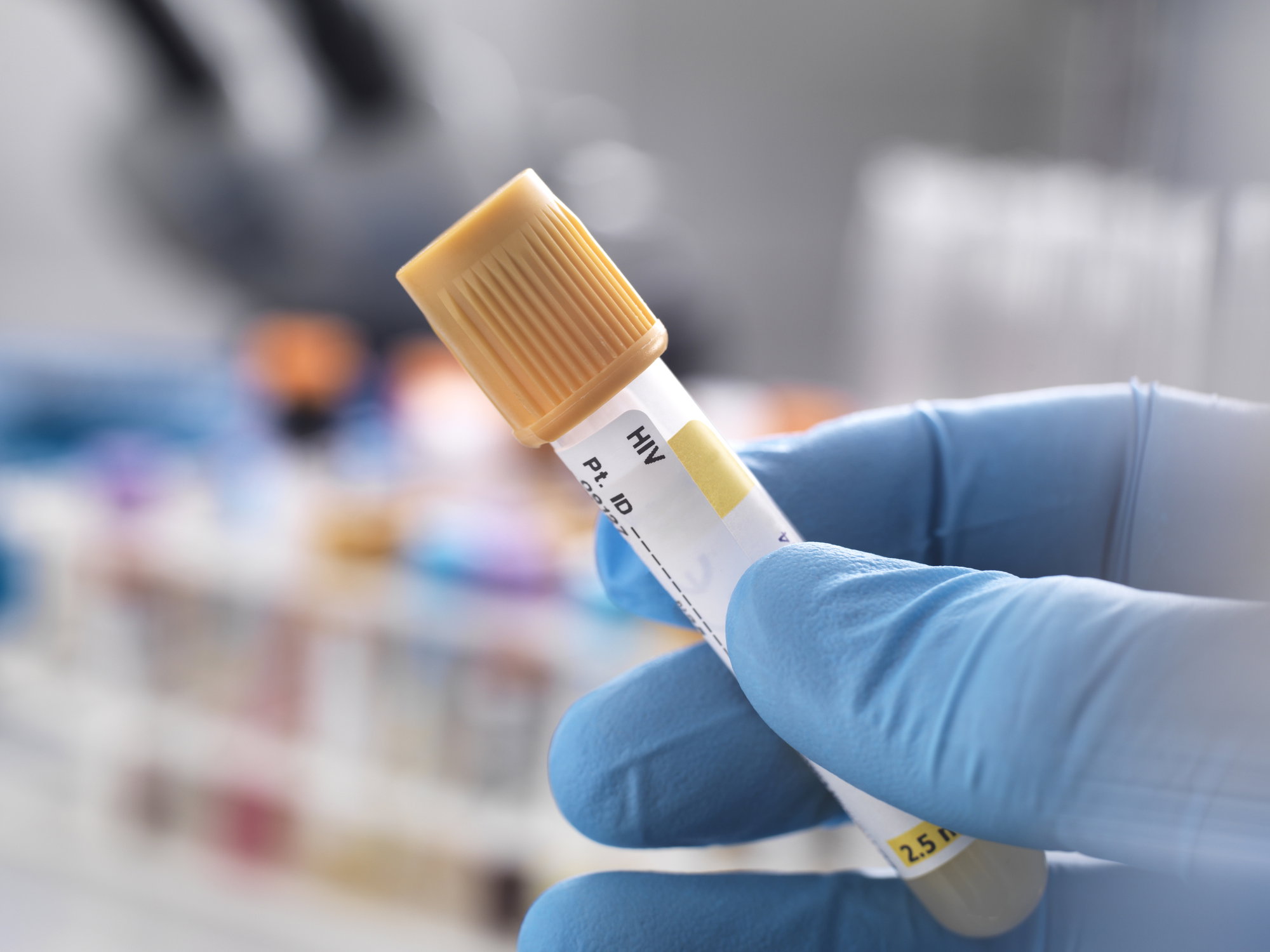 Drugi w histroii pacjent został uznany za wyleczoengo z HIV (fot. Getty Images)