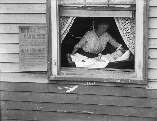 Podczas epidemii w 1916 r. amerykańska Rada Zdrowia kazała wywieszać na domach chorych ostrzeżenia, że w okolicy odnotowano przypadki polio.