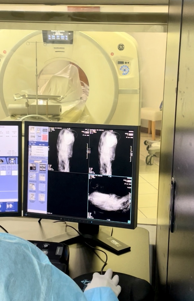 Gdy klinikę opuścili pacjenci, do tomografu wjechały... mumie