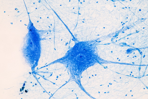 neuron