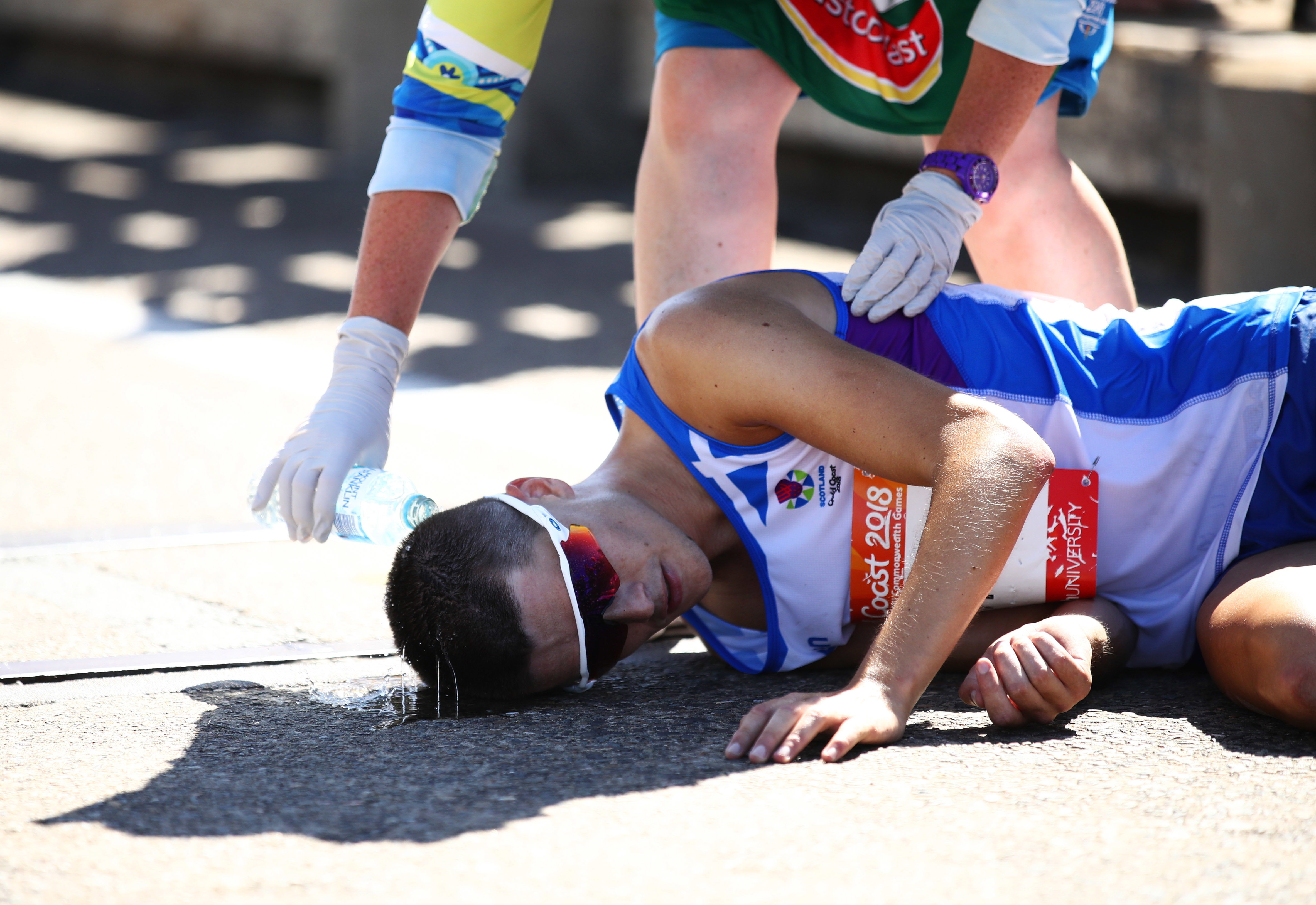 Udar cieplny to stan bezpośredniego zagrożenia życia. Szczególnie narażeni są m.in. sportowcy