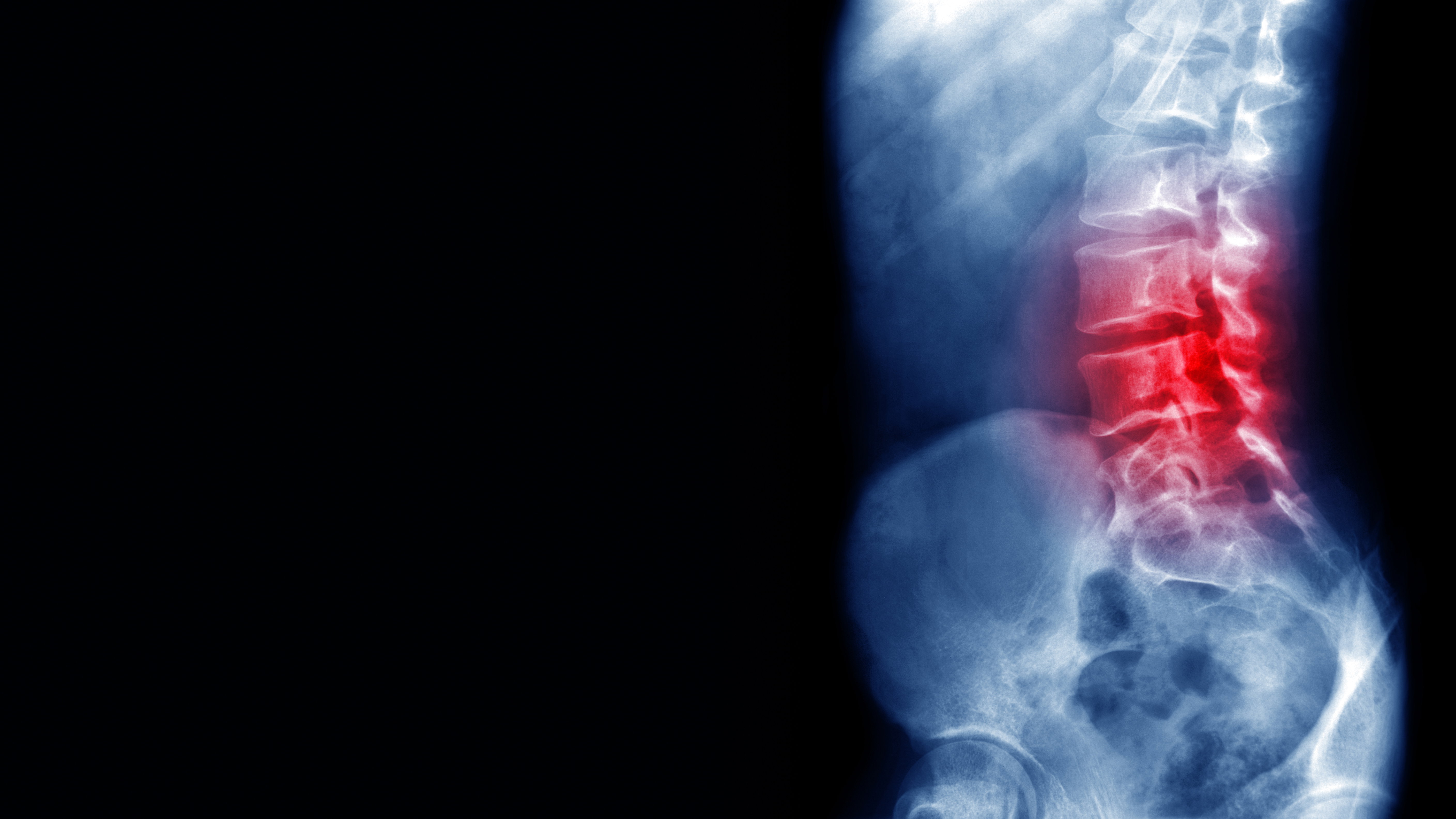 Przełom w neurobiologii. Innowacyjny biomateriał skutecznie połączył przerwany rdzeń kręgowy