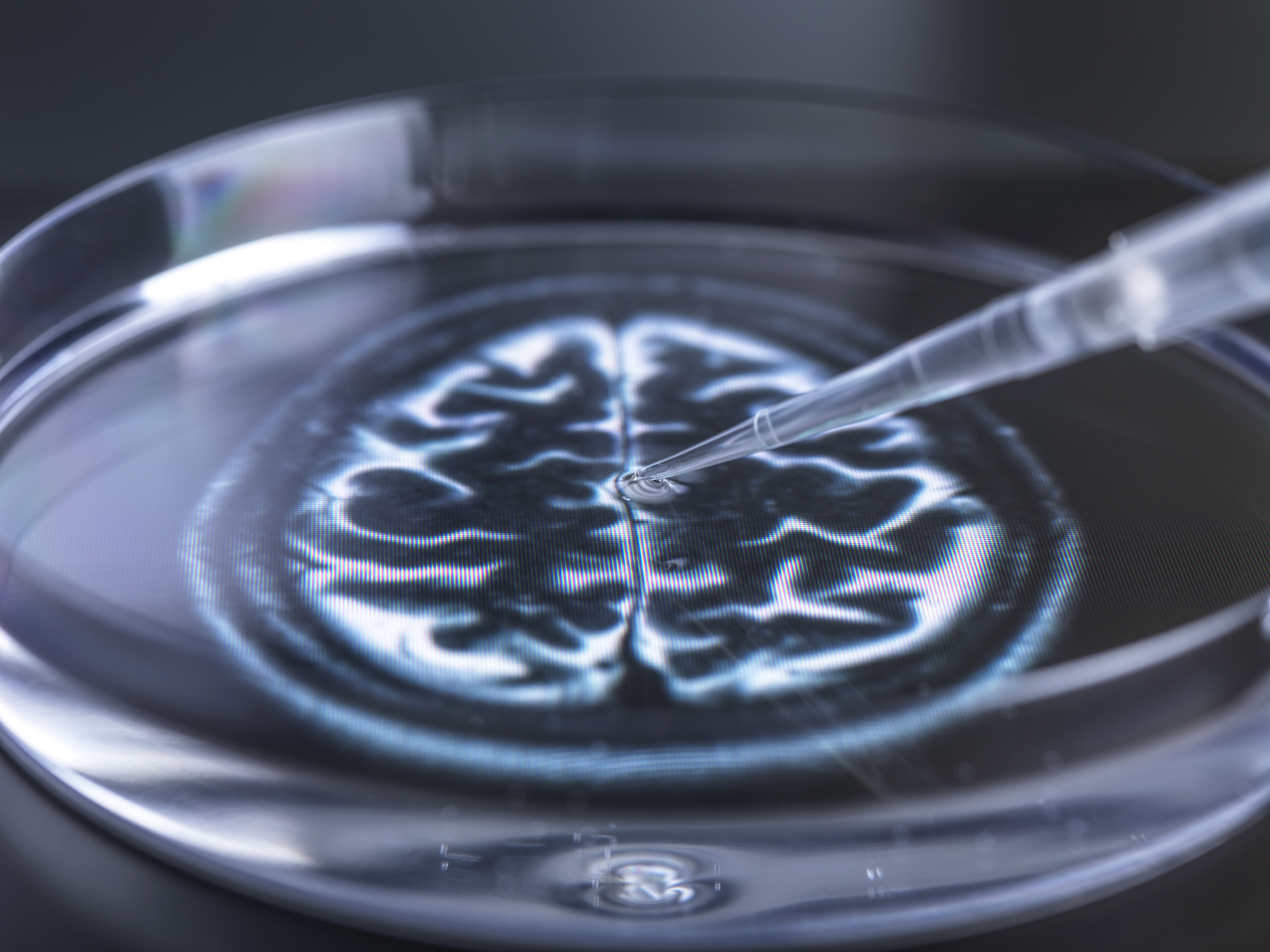 Dwa zastrzyki i koniec Alzheimera? U myszy to działa, a naukowcy mówią o przełomie