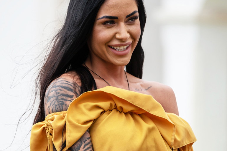 Stella z "Love Island 3" po operacjach plastycznych