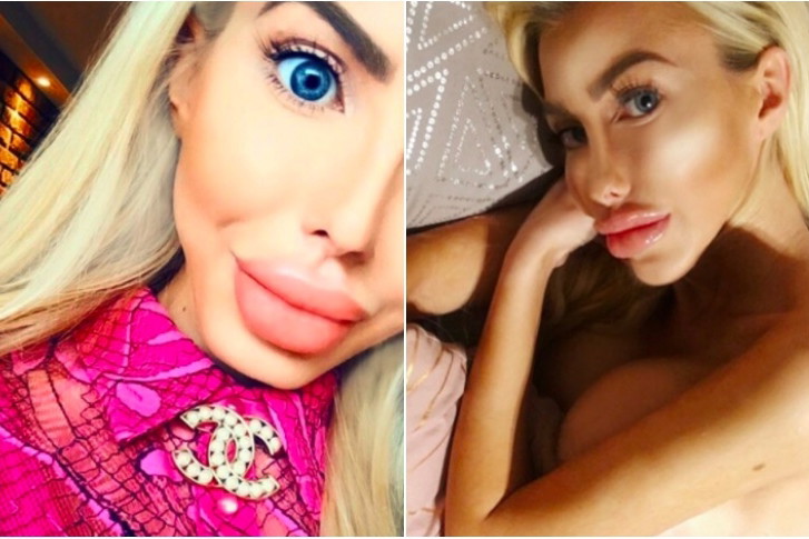 Anella