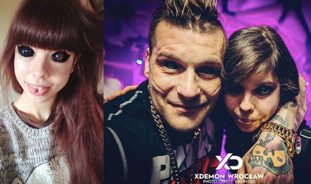 Fanka Popka Aleksandra Sadowska traci wzrok