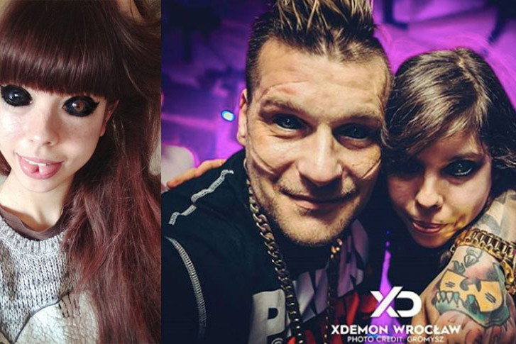 Fanka Popka Aleksandra Sadowska traci wzrok