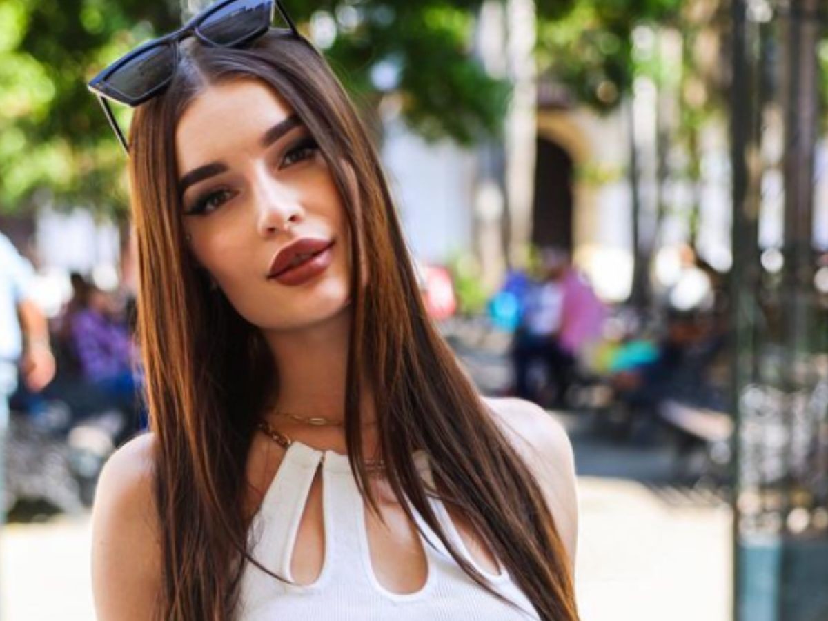 Hotel Paradise 7: Karolina tłumaczy, co się stało z jej ustami3