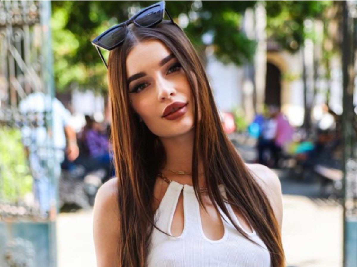 Hotel Paradise 7 Karolina przeszła ogromną metamorfozę. Pokazała, jak wyglądała bez powiększanych ust3