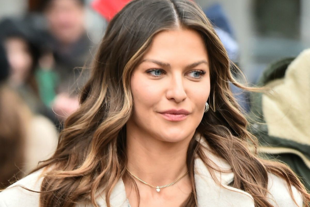 Anna Lewandowska o kolejnej operacji plastycznej