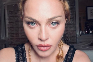 Madonna po wyjściu ze szpitala