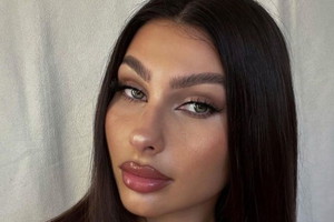 Hotel Paradise 5: Eliza pokazała, jak wyglądała przed powiększaniem ust4