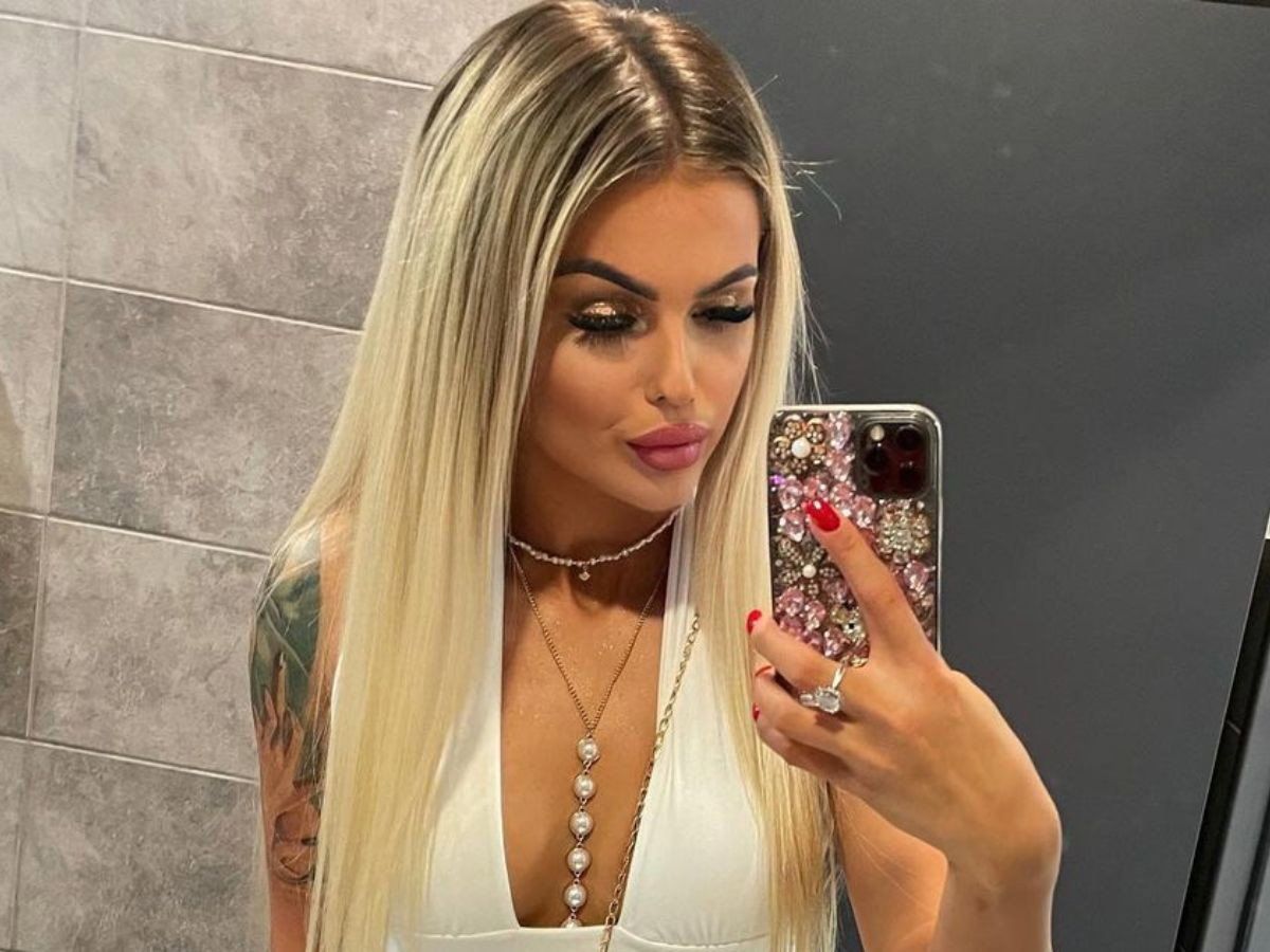 Love Island 7 Jagoda pokazała jak wyglądała przed zabiegami