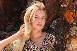 Hotel Paradise 5: Klaudia pokazała zdjęcie po operacji nosa9