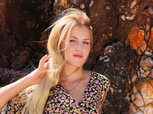 Hotel Paradise 5: Klaudia pokazała zdjęcie po operacji nosa9