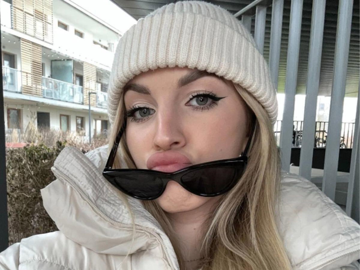 Hotel Paradise 5: Klaudia pokazała zdjęcie po operacji nosa3