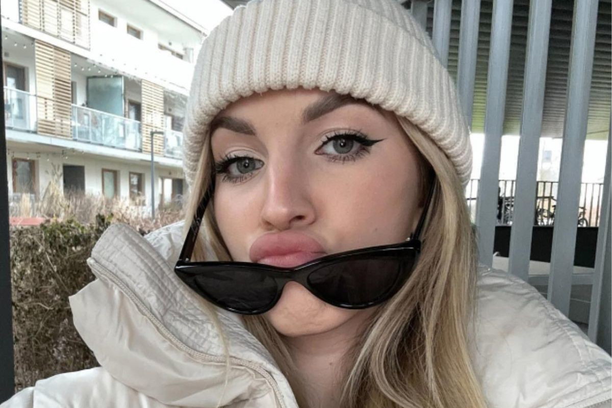 Hotel Paradise 5: Klaudia pokazała zdjęcie po operacji nosa3