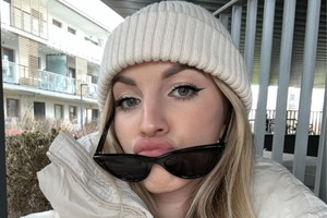 Hotel Paradise 5: Klaudia pokazała zdjęcie po operacji nosa3