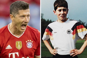 Lewy m
