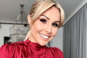 Blanka Lipińska pozbyła się wypełniaczy z całej twarzy1