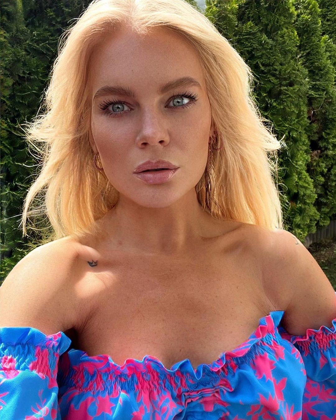 Love Island Magda powiększyła usta