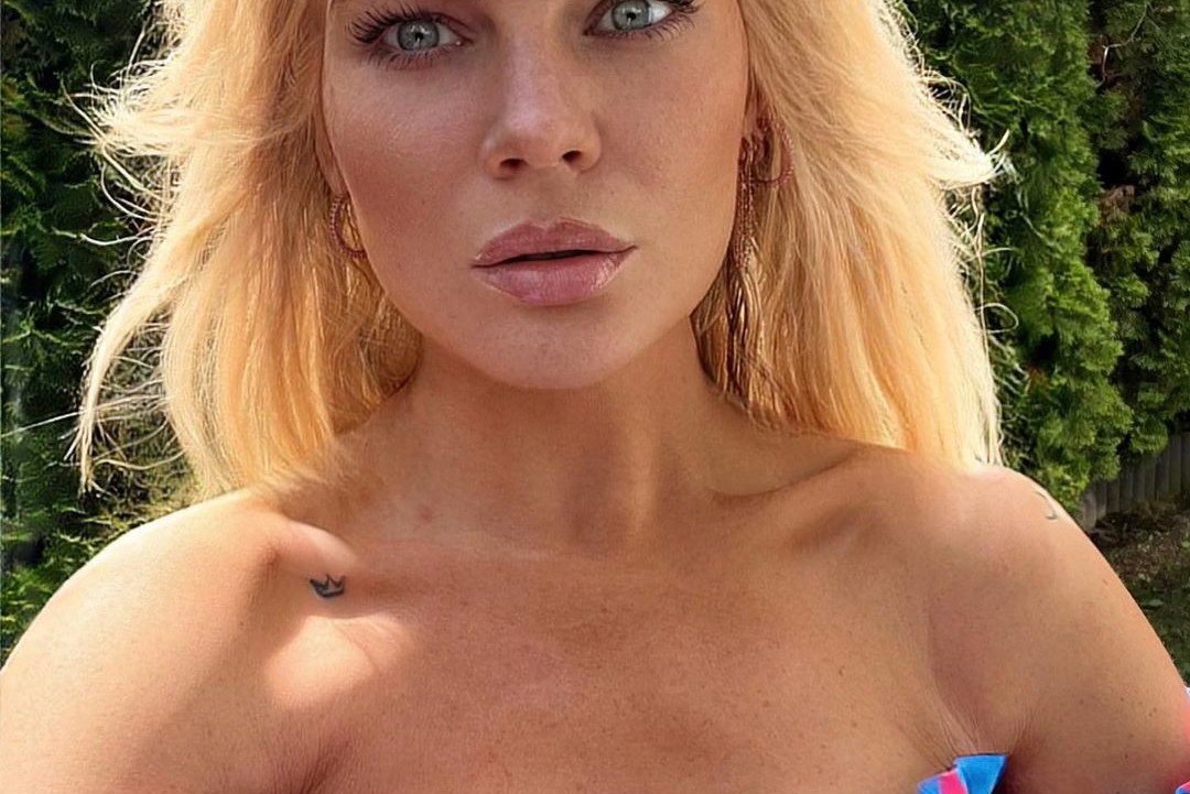 Love Island Magda powiększyła usta
