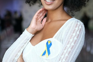 Hotel Paradise: Nana powiększyła usta