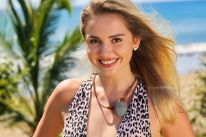 "Hotel Paradise 5": Karolina przyznała się do operacji plastycznej. Zdjęcia PRZED i PO