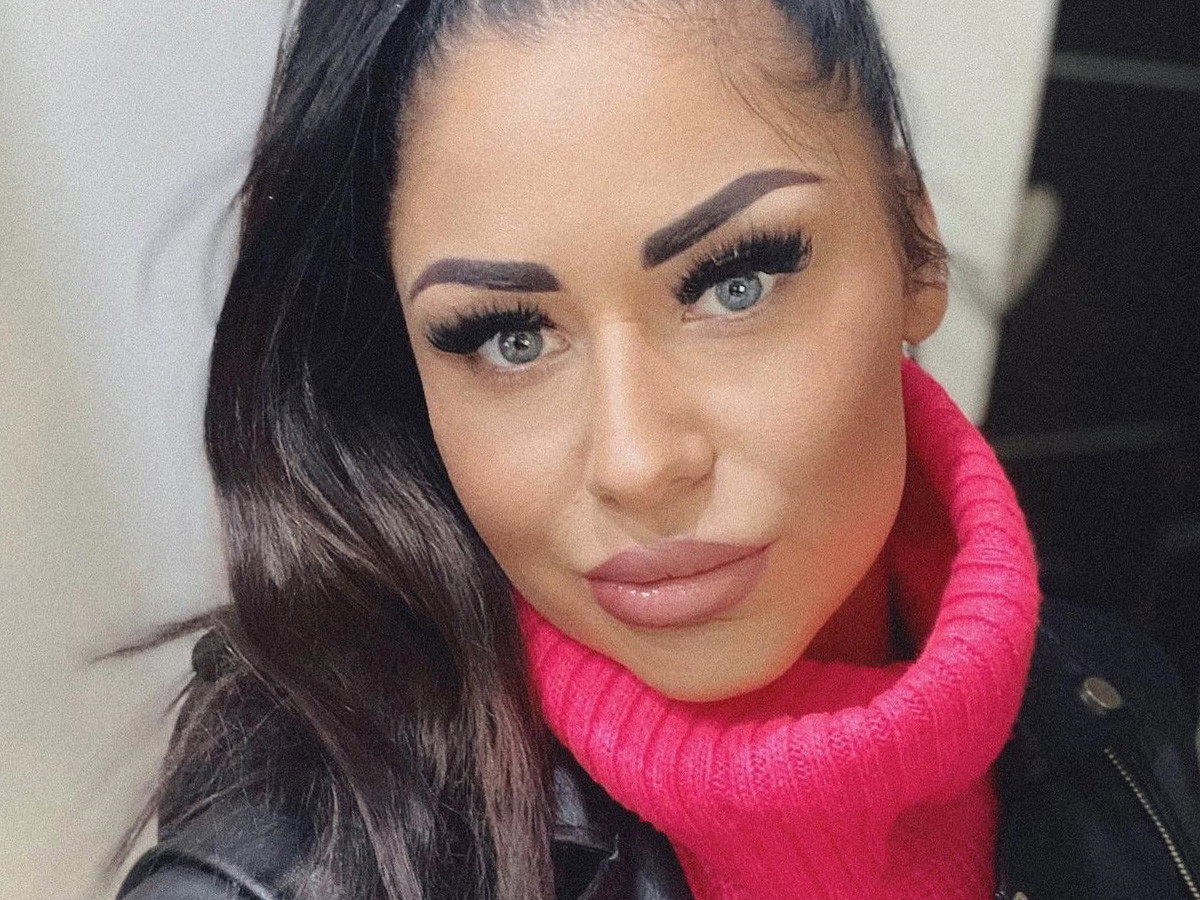 Stella z Love Island w ogniu krytyki. Chodzi o twarz