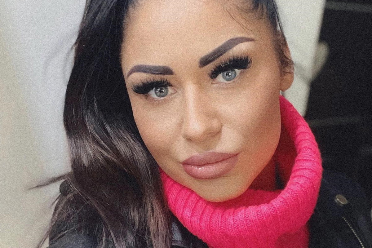 Stella z Love Island w ogniu krytyki. Chodzi o twarz