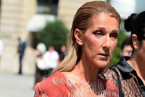 Celine Dion schudła jeszcze bardziej